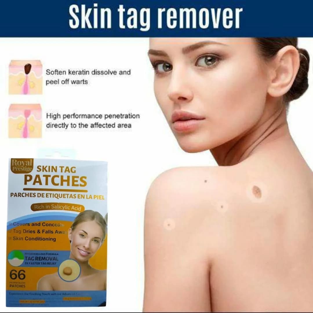 Skin Tag Remover Yellow Cotton 1 Pc