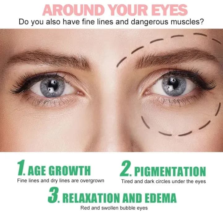 Under Eye Serum Dark Spot Removal 14 Days
