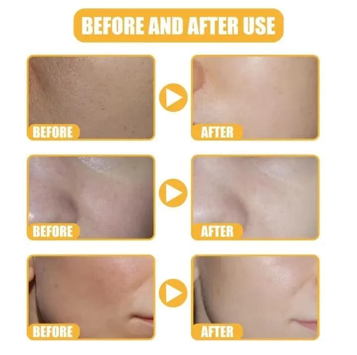White Rice Serum 50ml Skin Brightening Acne Marks Removal