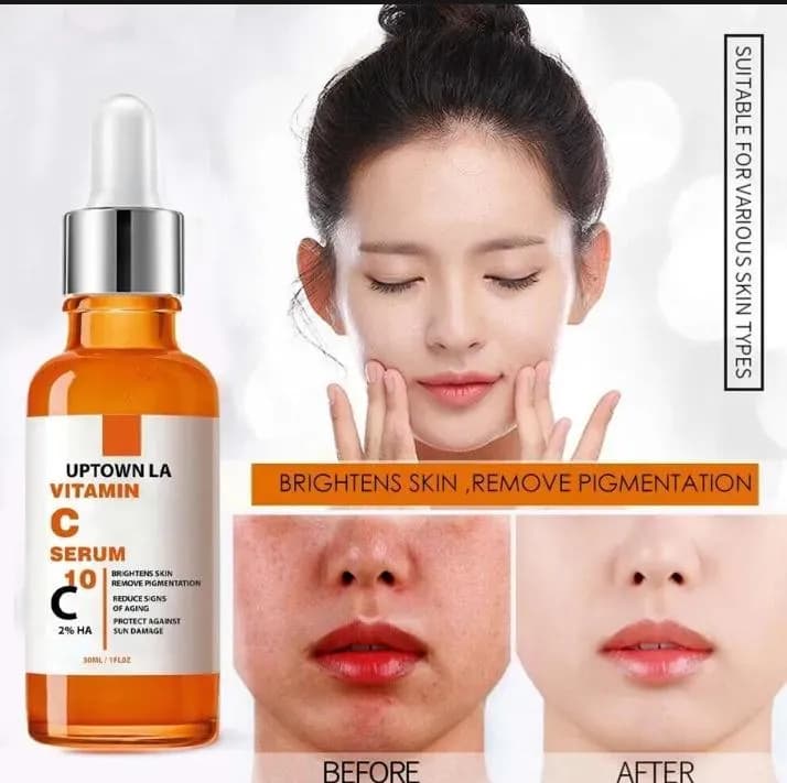 Vitamin C Serum for Acne Marks & Brightening