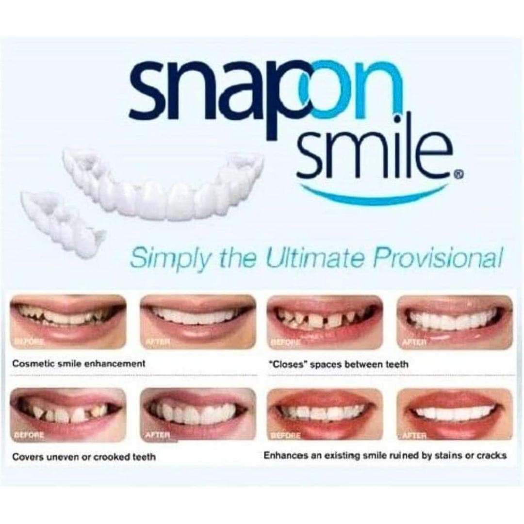 Snap On Fake Teeth White ABS for Instant Smile