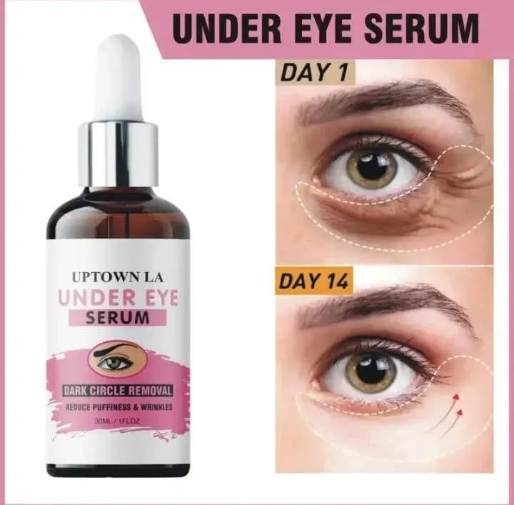 Under Eye Serum Dark Spot Removal 14 Days